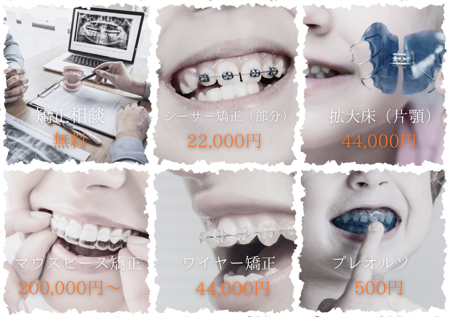 矯正治療メニュー